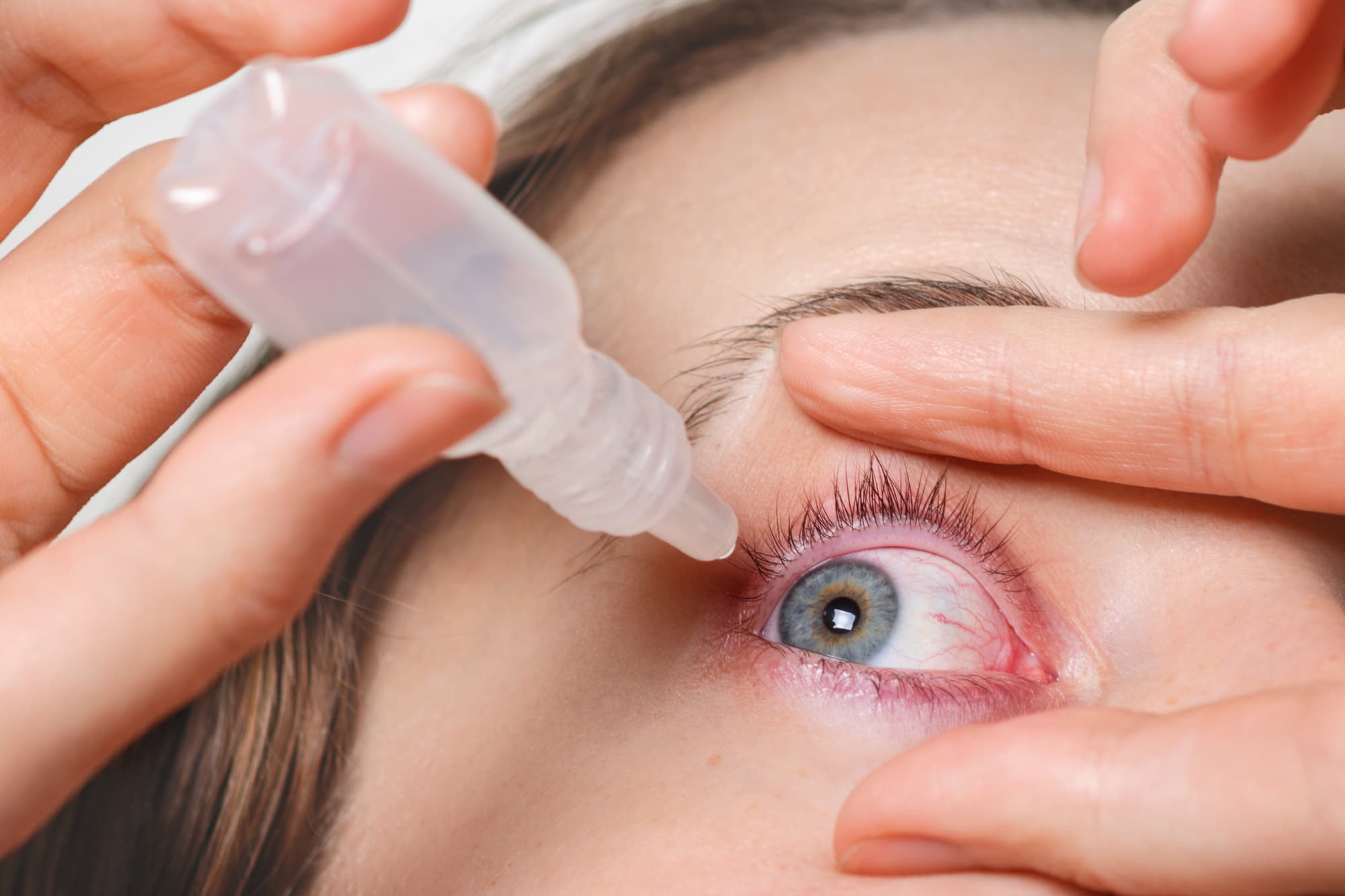 A Better Dry Eye Treatment by Lipiflow