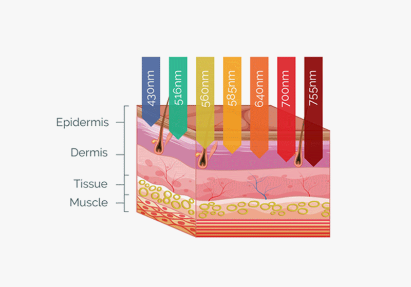 How LUCENT IPL works