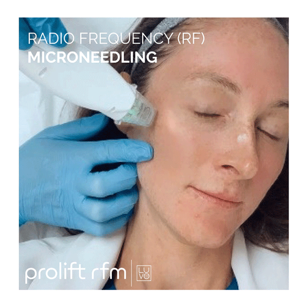 microneedling4